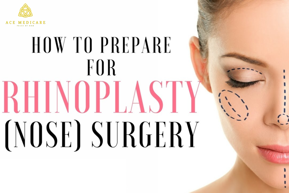 A Comprehensive Guide on How to Prepare for Rhinoplasty Surgery